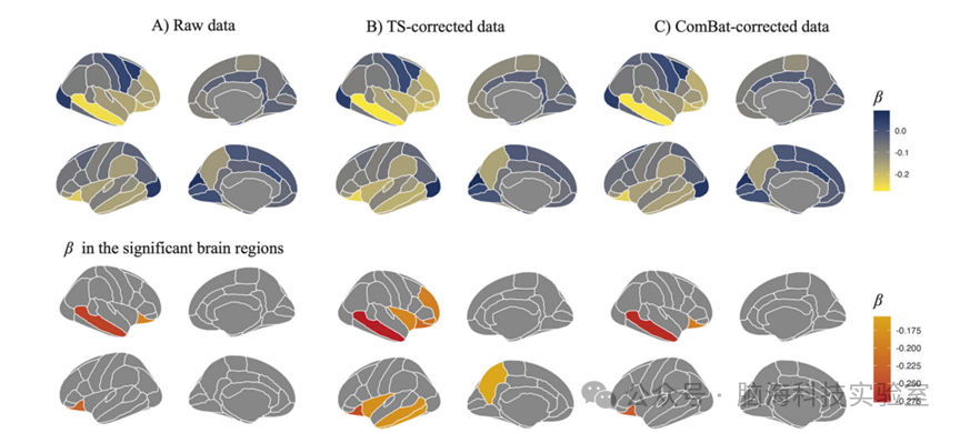 Mol Psychiatr：新发现！MRI校正方法提升了对注意缺陷多动障碍儿童脑结构的认识