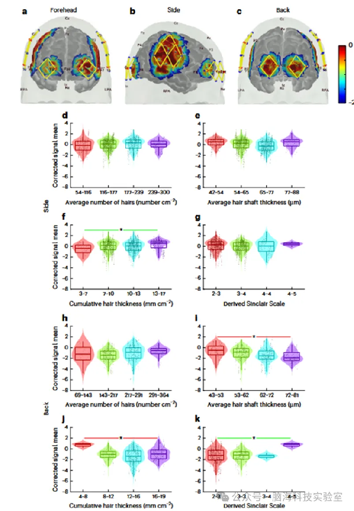 Nat. Hum. Behav：量化头发和皮肤特征对 fNIRS 信号质量的不同影响