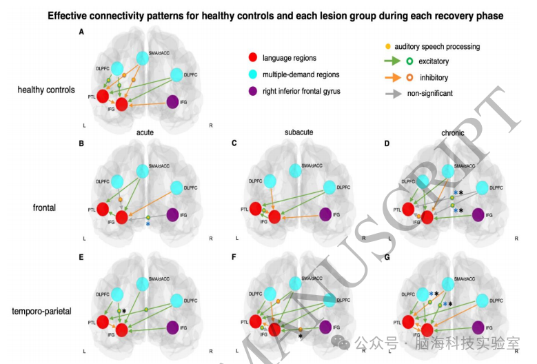 往期精彩|Brain：新发现！脑卒中失语症的动态网络重组过程