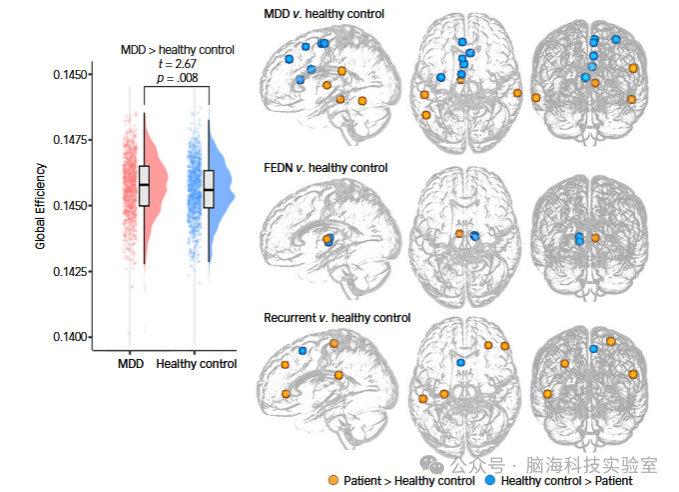 往期精彩|Br J Psychiatry：重度抑郁症患者灰质结构网络的拓扑结构和连接性受损：来自多中心神经影像数据集的证据