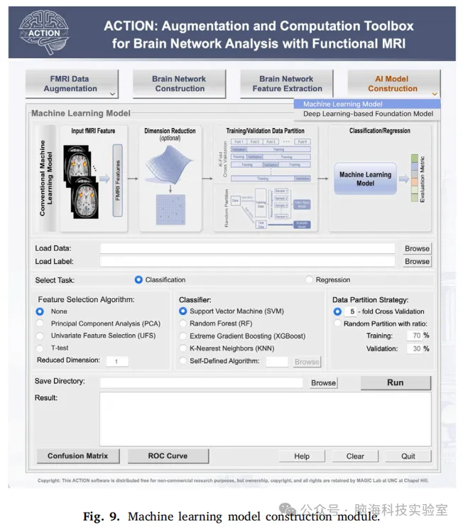 往期精彩|ACTION：用于功能性MRI脑网络分析的增强和计算工具箱