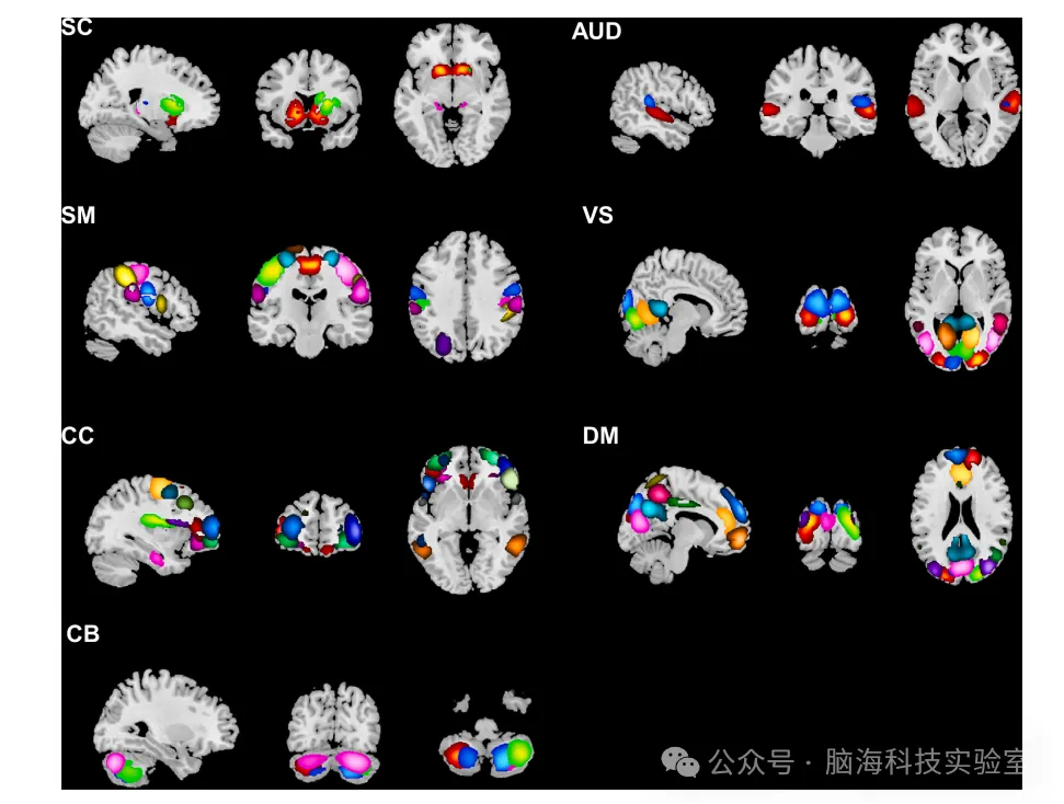 往期精彩|NeuroImage：膝关节炎如何影响大脑？静态与动态功能网络变化全解析