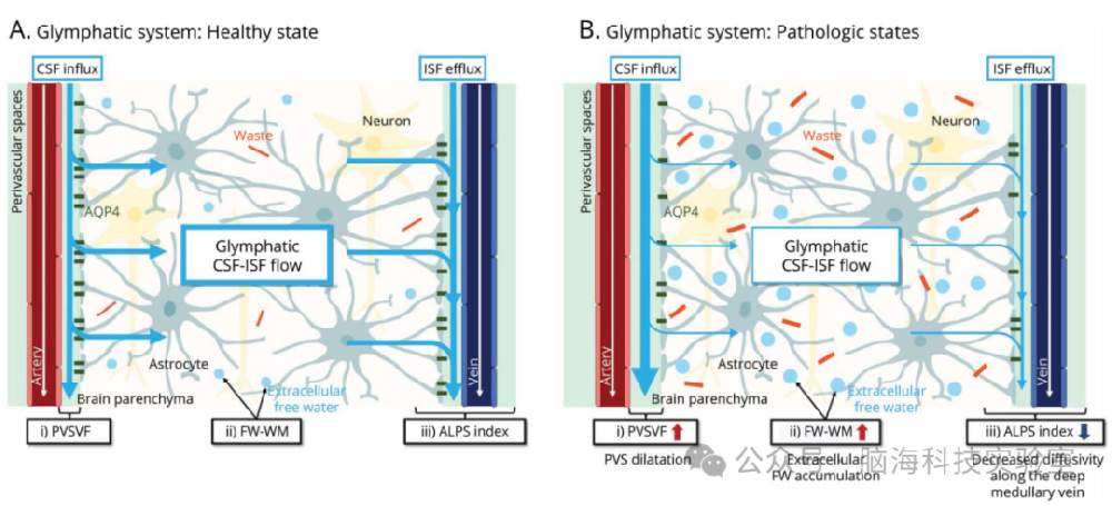 往期精彩|Neurology：轻度认知障碍和阿尔茨海默病中淋巴系统MRI指标与淀粉样蛋白沉积和认知的关系