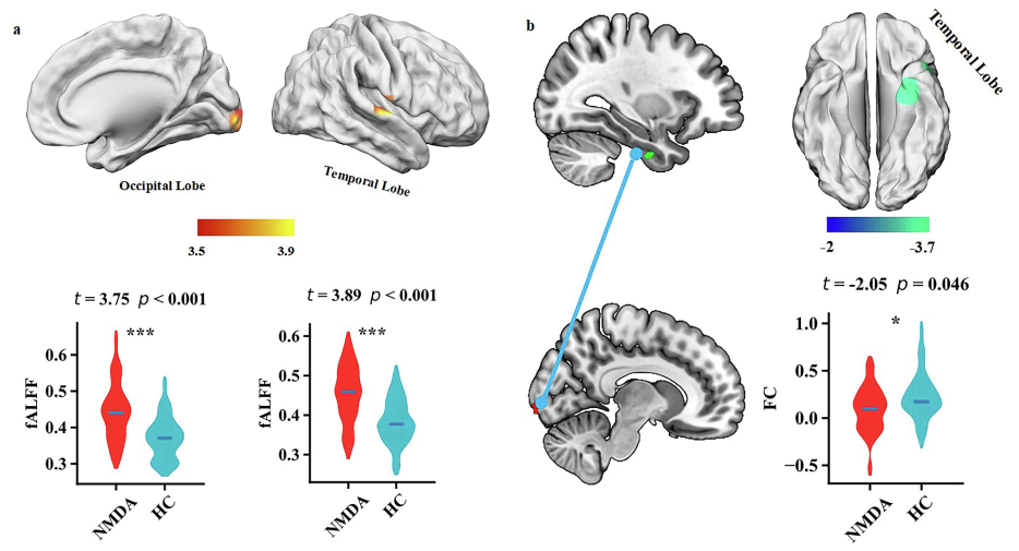 Neurobiol. Dis.：抗NMDAR脑炎脑功能活动改变的神经化学与分子特征研究