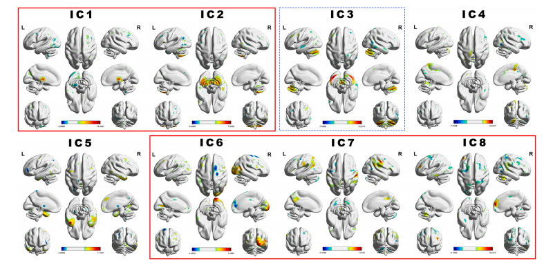 NeuroImage：通过脑结构协变网络预测认知老化：基于源的形态学分析的十年纵向洞察