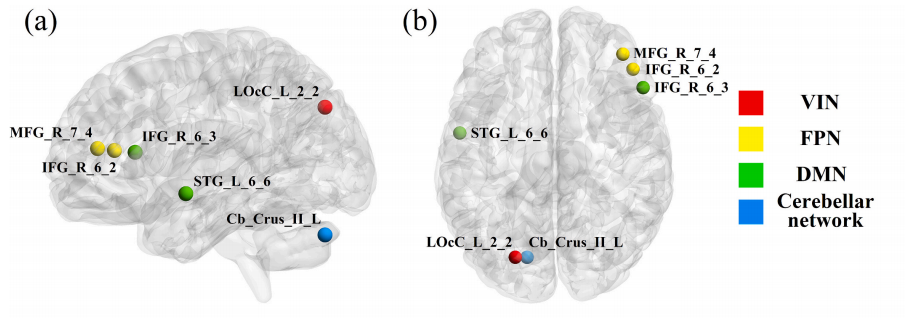 Neurobiol. Dis.：低阶与高阶功能网络拓扑破坏在伴冻结步态的多系统萎缩中：一项静息态研究