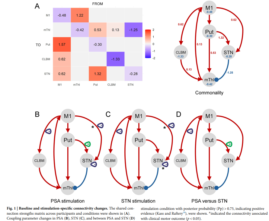 NPJ Parkinsons Dis: PSA与STN-DBS对帕金森病有效连通性的影响——一项3.0TfMRI成像研究