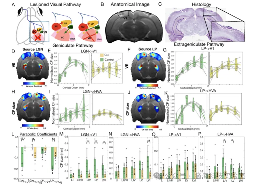 Nature Communications：超快 MRI 揭示大脑信号方向：新的扫描可能有助于解码自闭症、阿尔茨海默病和幻觉