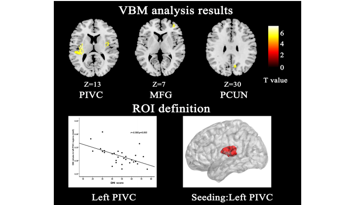 大脑形态学分析系统