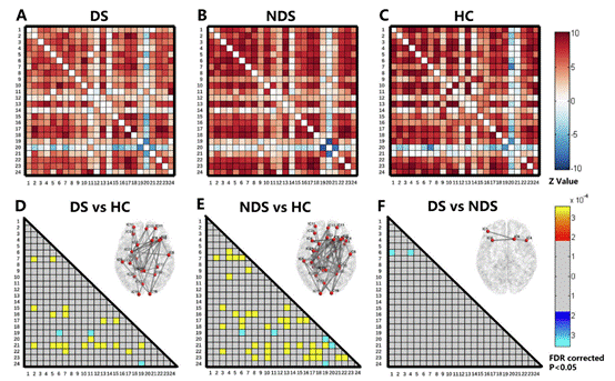 脑结构网络分析系统