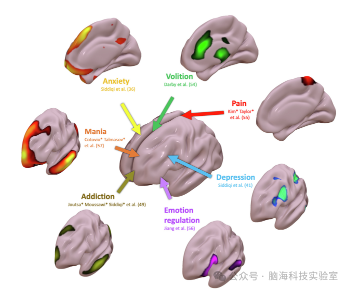 经颅磁刺激靶向治疗的特异性网络