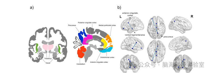 Journal of Affective Disorder:重度抑郁症的超高场成像:结构和功能研究