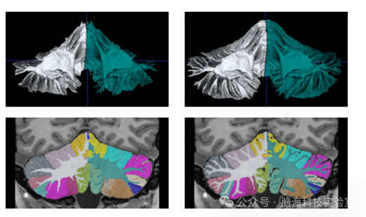 NeuroImage：AI 驱动的DeepCeres软件通过详细的成像重新定义小脑研究