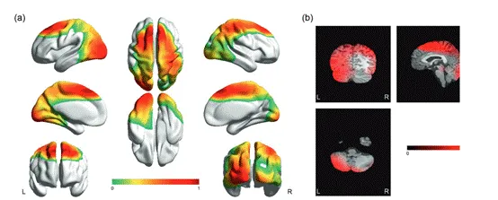 Neuropsychopharmacol：深度学习结合精神分裂症状严重程度可以有效提高对患者的识别能力
