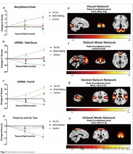 Transl Neurodegener. ：长期太极训练改善帕金森病患者运动症状的机制