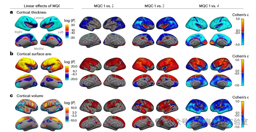 Nature Neuroscience：解决脑发育的大型自动化MRI分析中的人为偏差