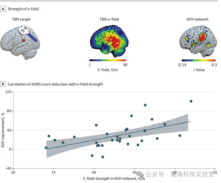 往期精彩|JAMA Netw. Open：重复经颅磁刺激（rTMS）为精神分裂症患者带来新希望