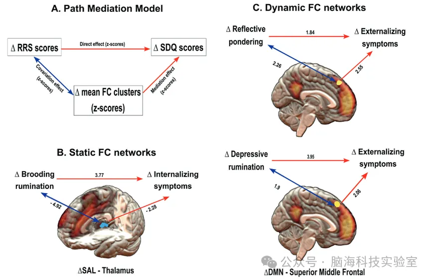 Mol Psychiatr：在向成年过渡的过程中，反刍思维和休息状态大脑网络之间的耦合变化
