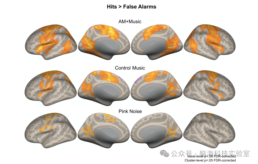 往期精彩|Nature子刊：音乐中的快速节奏变化帮助注意力不集中的听众保持专注！