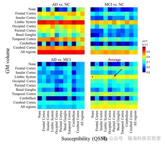 Eur Radiol：基于定量磁化率成像和体素形态学测量的诊断指标可能有助于改进阿尔茨海默病的早期诊断