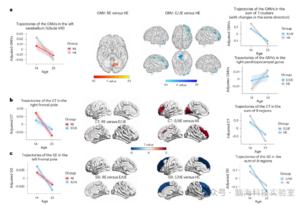 往期精彩|《自然》子刊:最新发现!青少年不健康饮食习惯的神经机制:大脑延迟成熟与遗传风险的双重影响