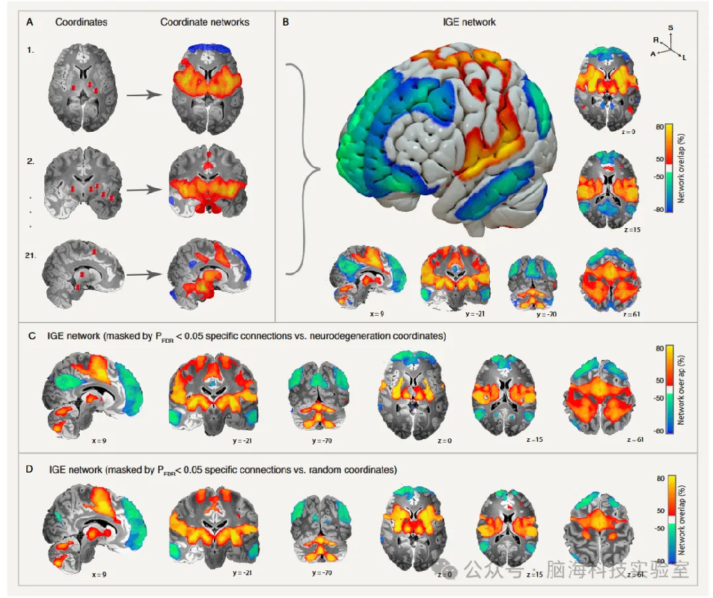 往期精彩|Nature子刊：科学家绘制与全身性癫痫发作相关的大脑网络图谱，为新的脑刺激疗法铺平道路