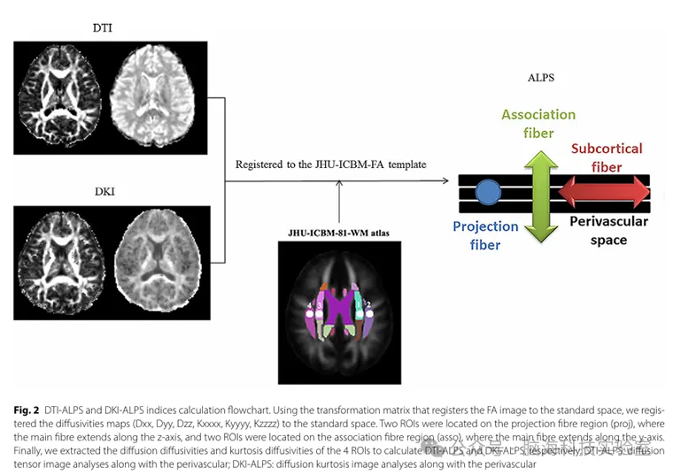 J Headache Pain：偏头痛患者的脑脊液淋巴系统功能异常：一项扩散峰度成像研究