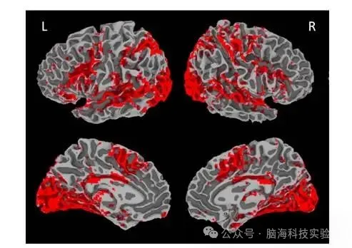 往期精彩|Hum Brain Mapp :双语大脑如何分工?脑科学研究揭示语言表征奥秘