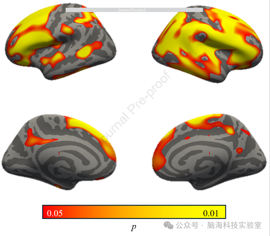 BIOL PSYCHIAT-COGN N：新研究！揭示PTSD与大脑结构的相关性