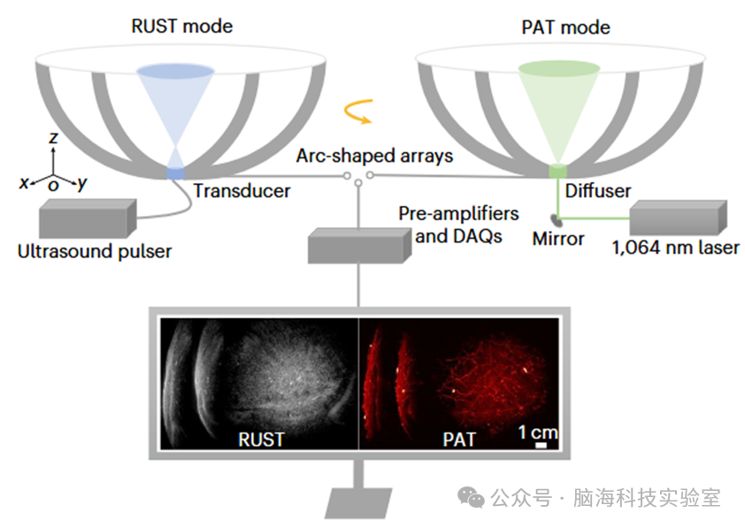 Nature子刊:新技术!三维混合成像系统可以弥补MRI、CT和超声的局限性