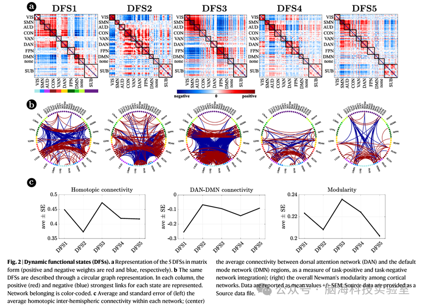 往期精彩|Nat Commun：中风后，大脑皮层与皮层下的动态连接被打破