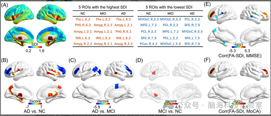 往期精彩|阿尔茨海默病合集 | 以往高分文献分析,揭示阿尔茨海默病研究热点