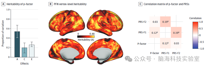 JAMA Psychiatry：多基因风险、精神病理学与青少年个体化功能性脑网络地形图