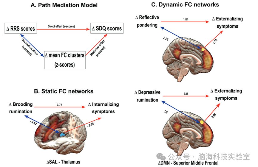 往期精彩|Mol Psychiatr：在向成年过渡的过程中，反刍思维和休息状态大脑网络之间的耦合变化