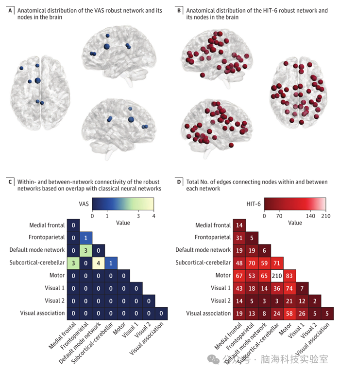 JAMA Network Open：无先兆偏头痛的针灸治疗及其关联性的疗效预测