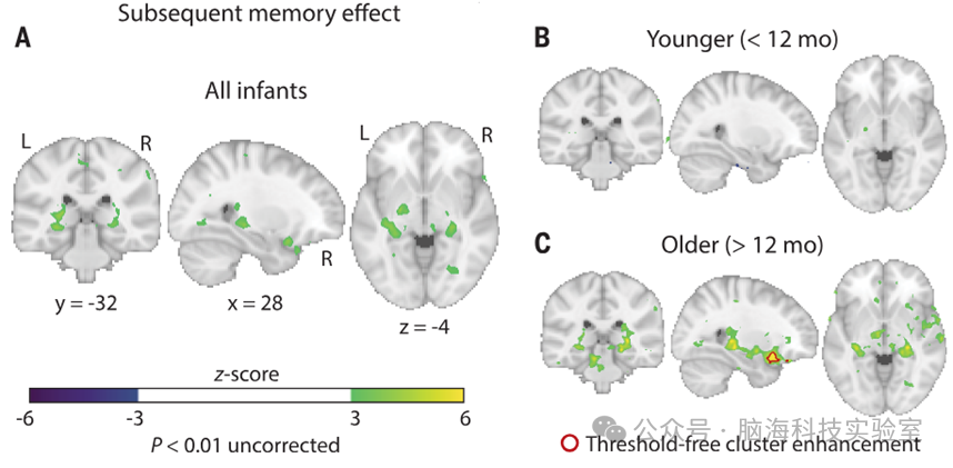 Science：人类婴儿记忆的海马编码