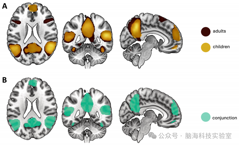 Commun Biol.：儿童和成人心理化过程中大脑功能和连接模式的演变